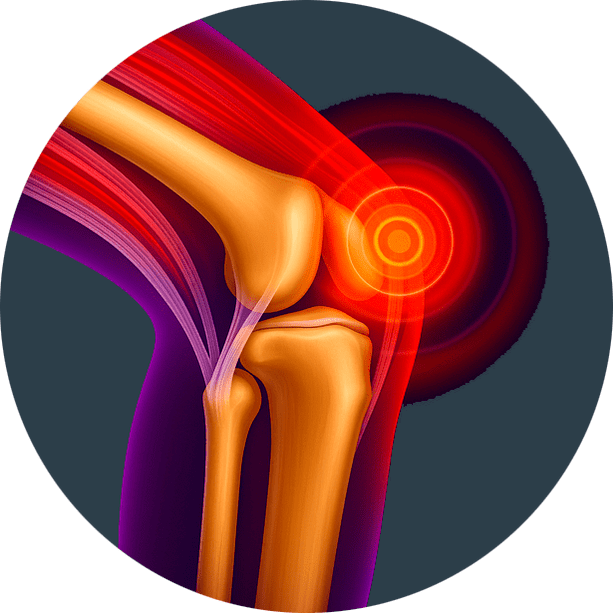 Inflamación articular