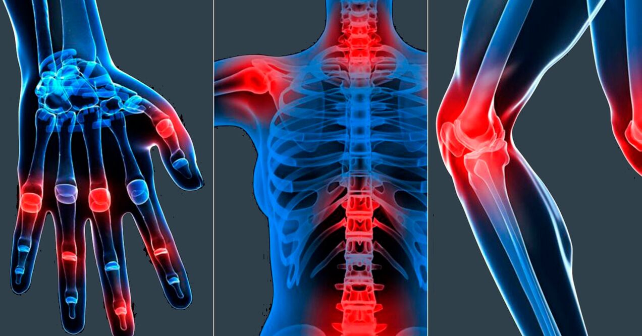 Instrucións para usar o extracto de boswellia en cápsulas