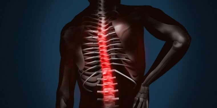 Lesións da columna vertebral por osteocondrose